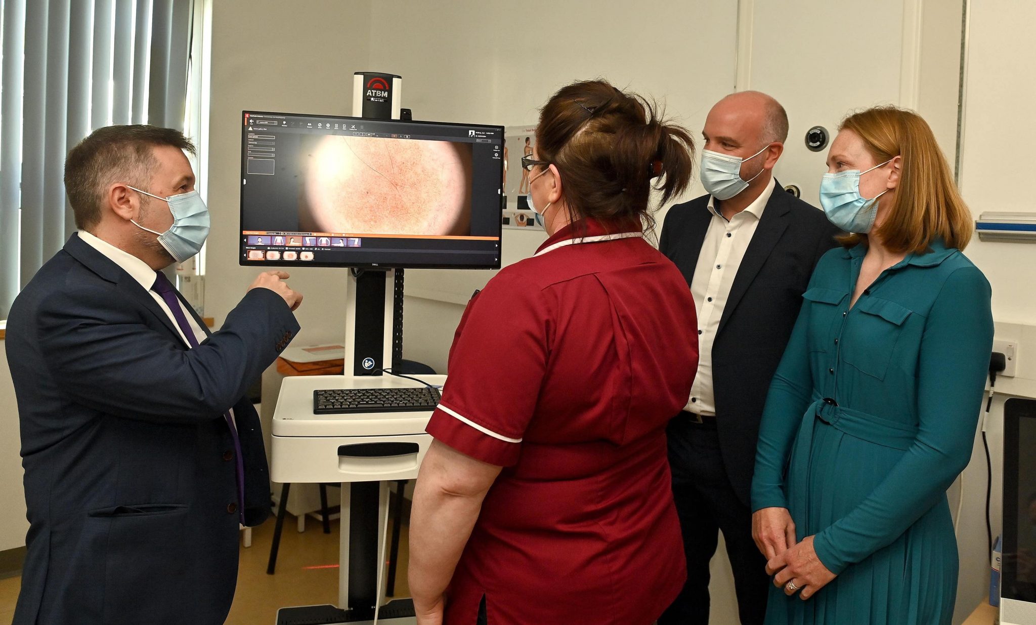 Mole-mapping service at Ulster Hospital first of its kind in Northern Ireland